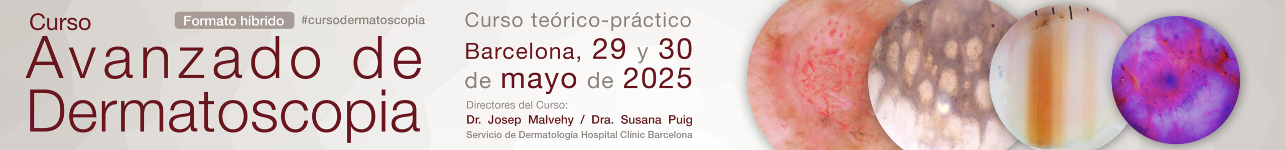 Curso Avanzado de Dermatoscopia