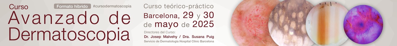 Curso Avanzado de Dermatoscopia